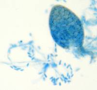 Ampelomyces quisqualis image