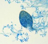 Ampelomyces quisqualis image