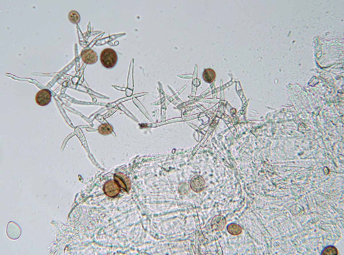 Acremoniella atra image