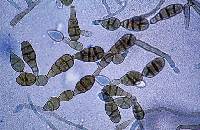 Alternaria enhydrae image