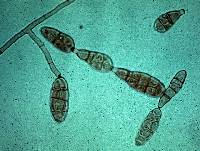 Alternaria ascalonici image