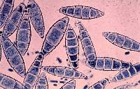 Arthroderma gypseum image