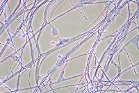 Acremonium argemonis image