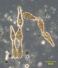 Alternaria ascalonici image