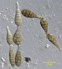 Alternaria albizziae image