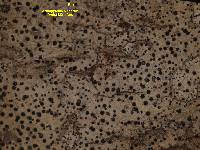 Arthopyrenia planorbis image