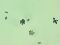 Rhizopogon atroviolaceus image
