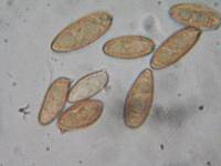 Tylopilus porphyrosporus image