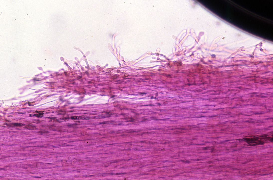 Entoloma myrmecophilum var. atrogaleatum image