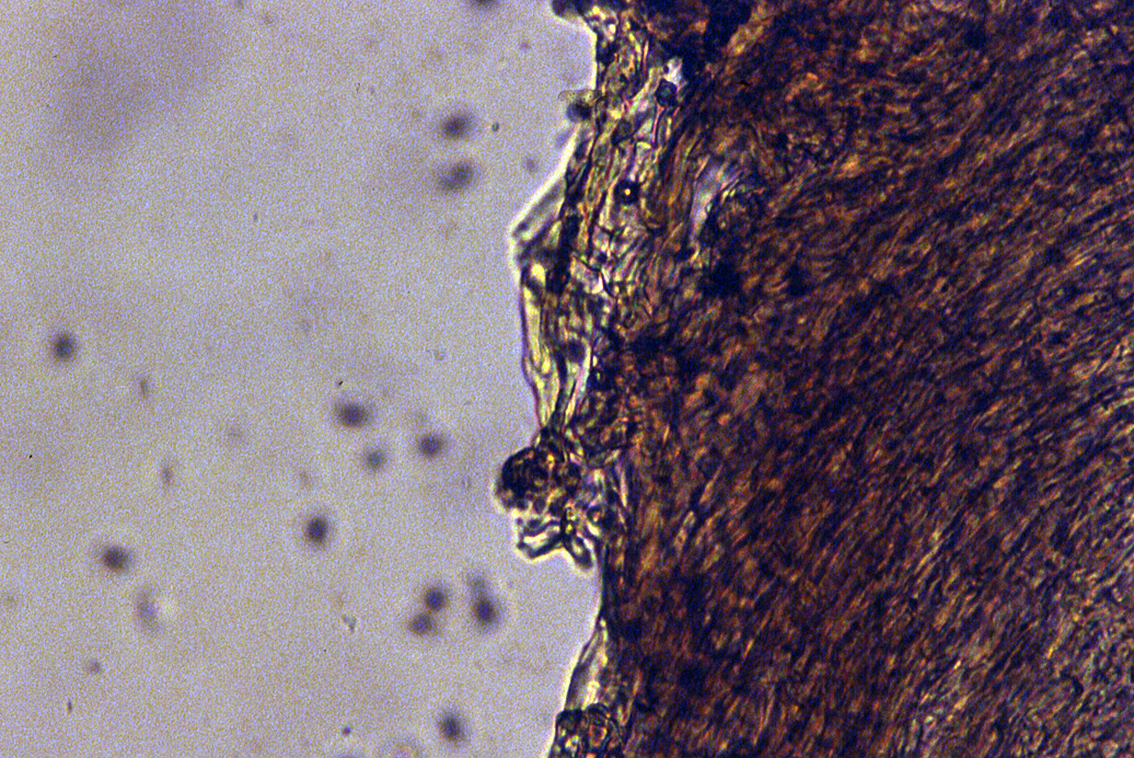 Inocephalus minimus image