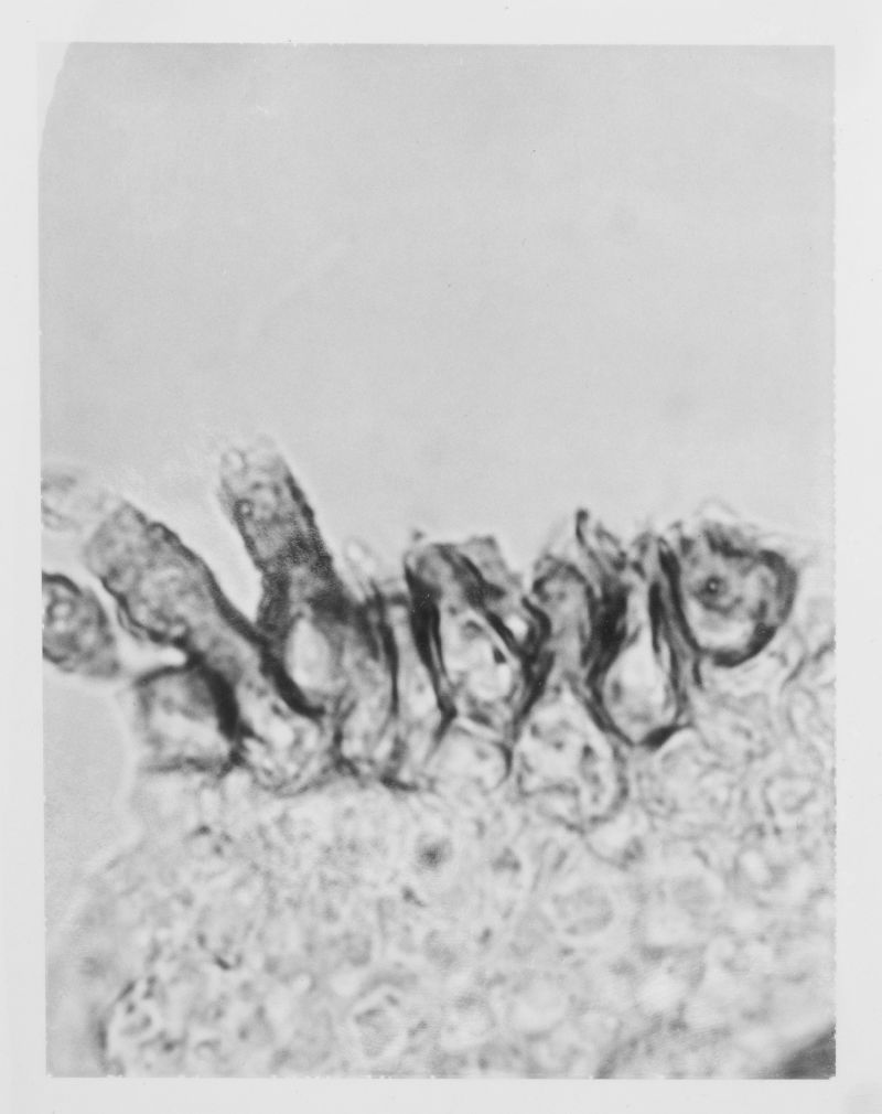 Spilocaea pyracanthae image