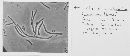 Blumeriella jaapii image