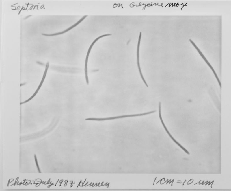 Septoria glycines image