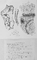 Kretzschmaria deusta image