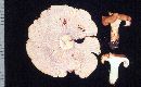 Cantharellus formosus image